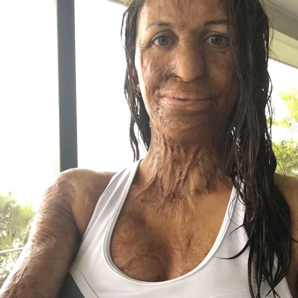 Turia Pitt has revealed she is struggling with breastfeeding