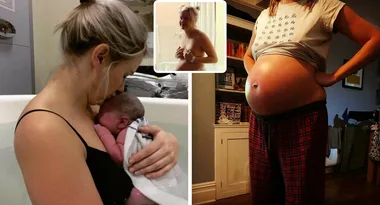 Why this post birth photo has gone viral