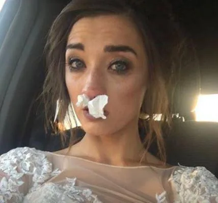 Bride suffers allergic reaction to her wedding bouquet
