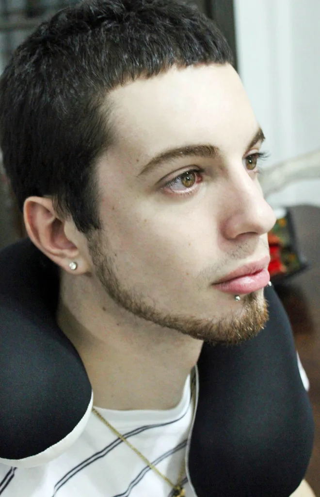 Luis Padron underwent $60,000 of surgery to become a real life elf