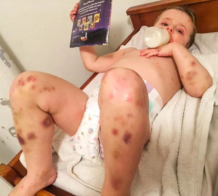 mother fighting for sons life