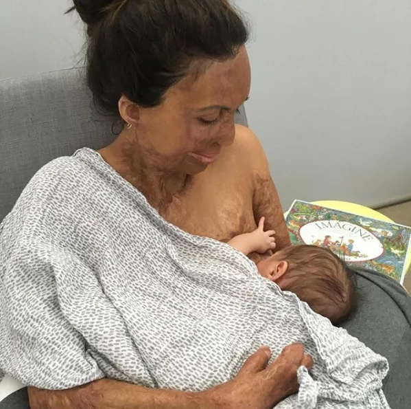 Turia Pitt tells all: The day my baby boy was born