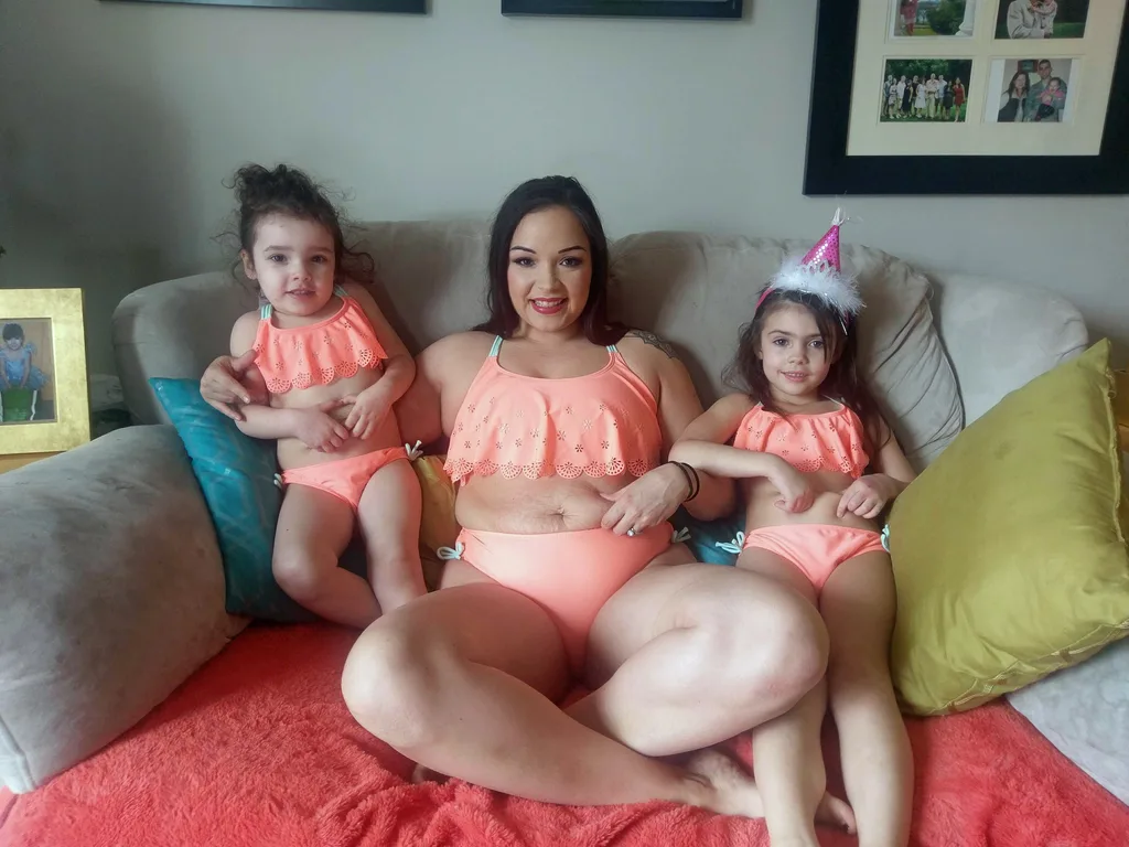 Mum becomes internet star after learning to love her stretchmarks