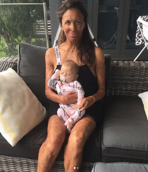Turia Pitt reveals what her baby’s name means