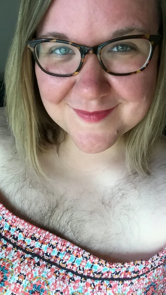 Woman who felt like a ‘freak’ because of her excess body hair learns to embrace natural look