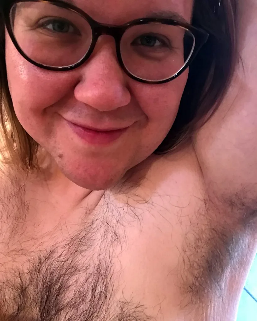 Woman who felt like a ‘freak’ because of her excess body hair learns to embrace natural look