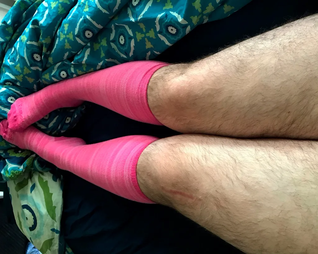 Woman who felt like a ‘freak’ because of her excess body hair learns to embrace natural look