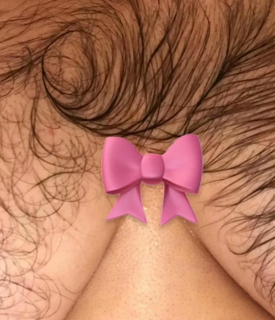 Woman who felt like a ‘freak’ because of her excess body hair learns to embrace natural look