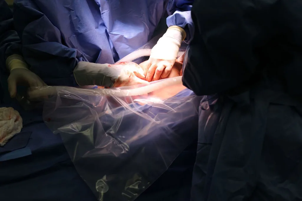 Baby Annabelle was born inside her amniotic sac &ndash; see the incredible pics