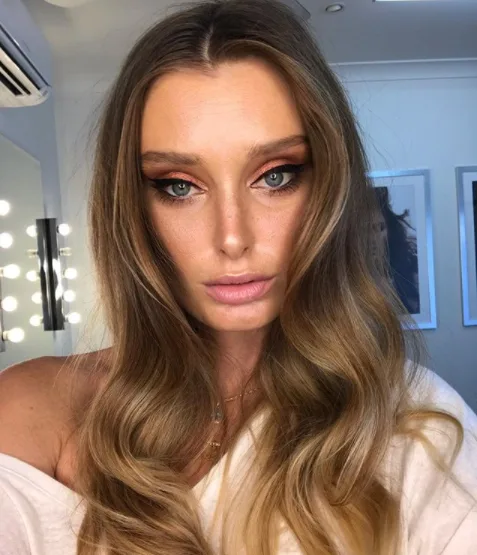 Model struck by mystery virus in Bali which led to a HEART TRANSPLANT opens up about her scars