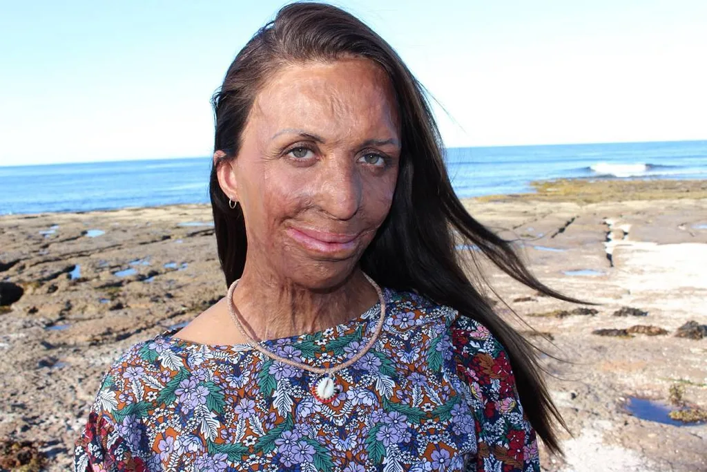 Turia Pitt: ‘People say I’m lucky to have Michael but luck has nothing to do with it’