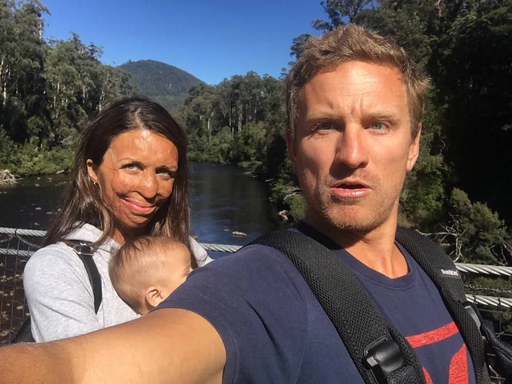 Turia Pitt: ‘People say I’m lucky to have Michael but luck has nothing to do with it’
