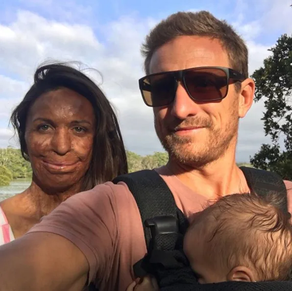 Turia Pitt shares adorable new photos of her son