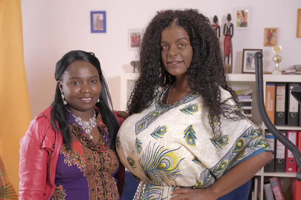 Controversial white model who ‘transformed into an African woman’ shares new surgery plans