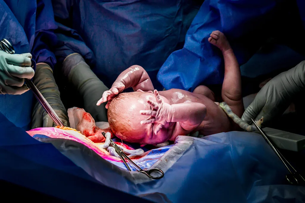 The birth pictures BANNED for being ‘pornographic’