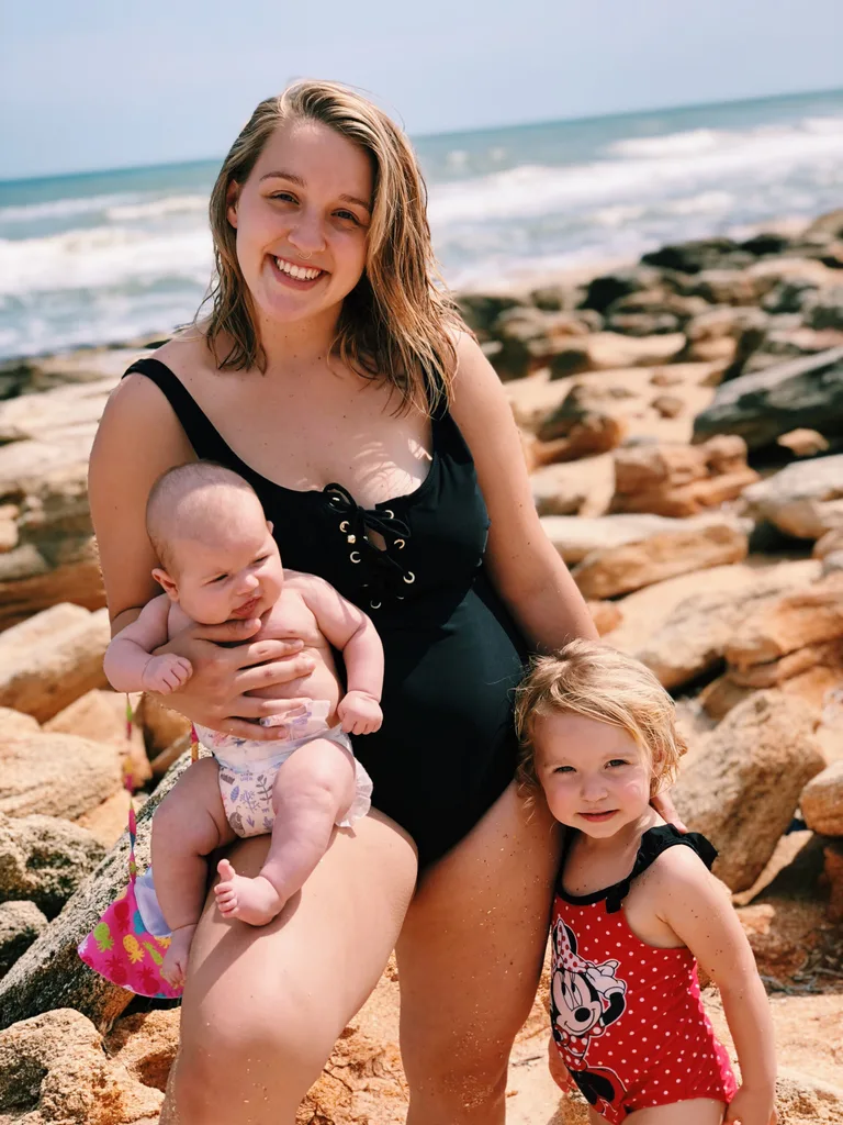 Why this mum-of-two is baring her C-section scar