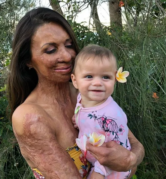 The heartwarming reason Turia Pitt is sharing this throwback pic