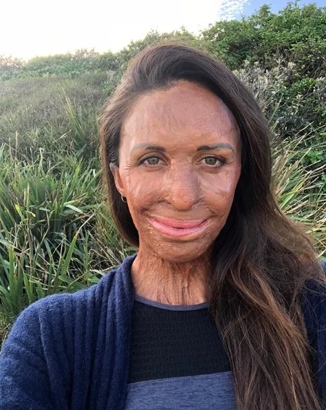 The heartwarming reason Turia Pitt is sharing this throwback pic