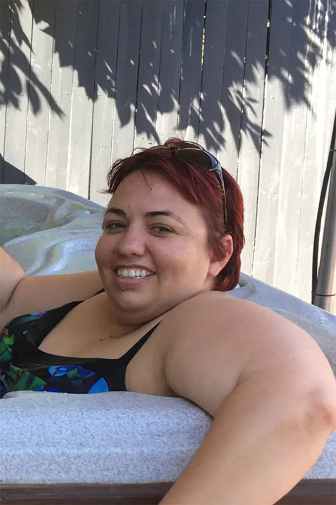 before surgery