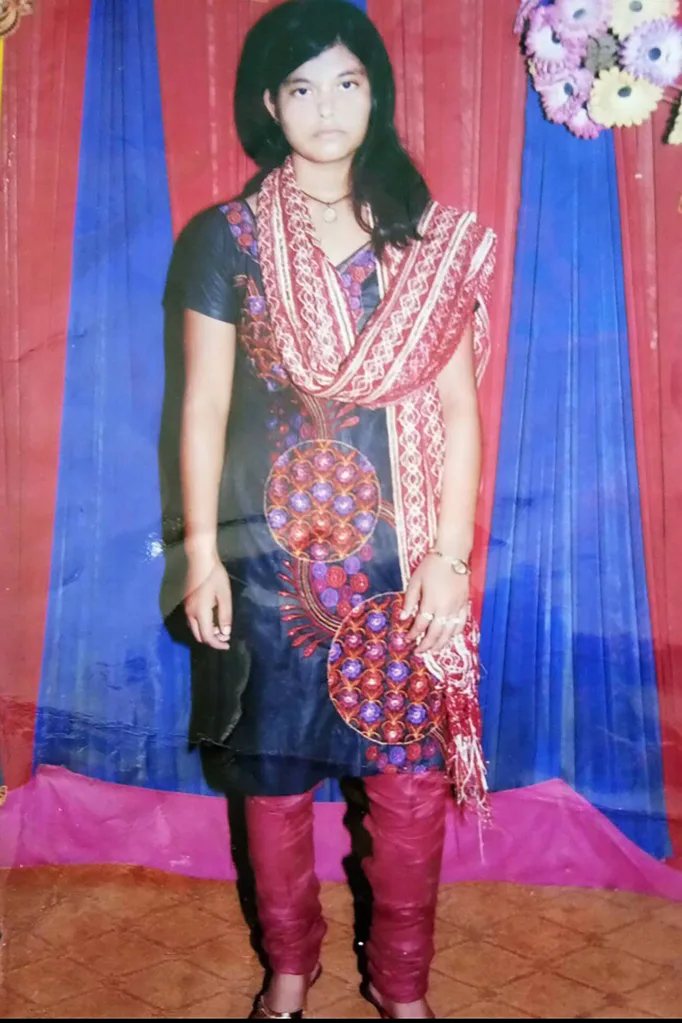 Acid attack survivor talks about moment she was scarred for life