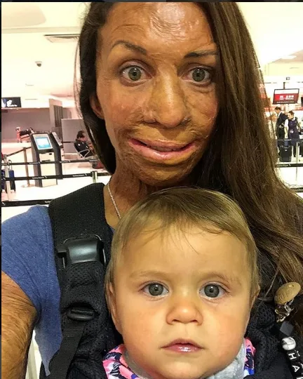 Turia Pitt: Don’t call me a burns victim