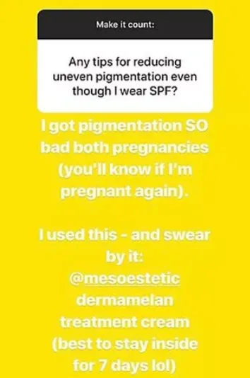 Lara Worthington/Instagram