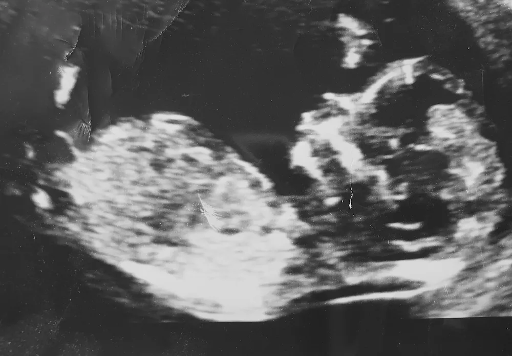 Baby born with full head of hair wows in video