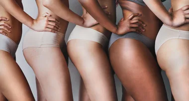 What causes stretch marks and how do you get rid of them?