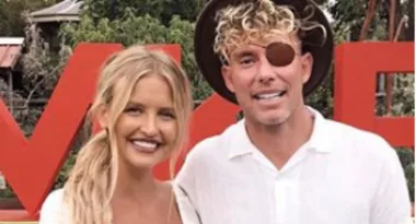 MKR’s Ash reveals what’s under his eyepatch