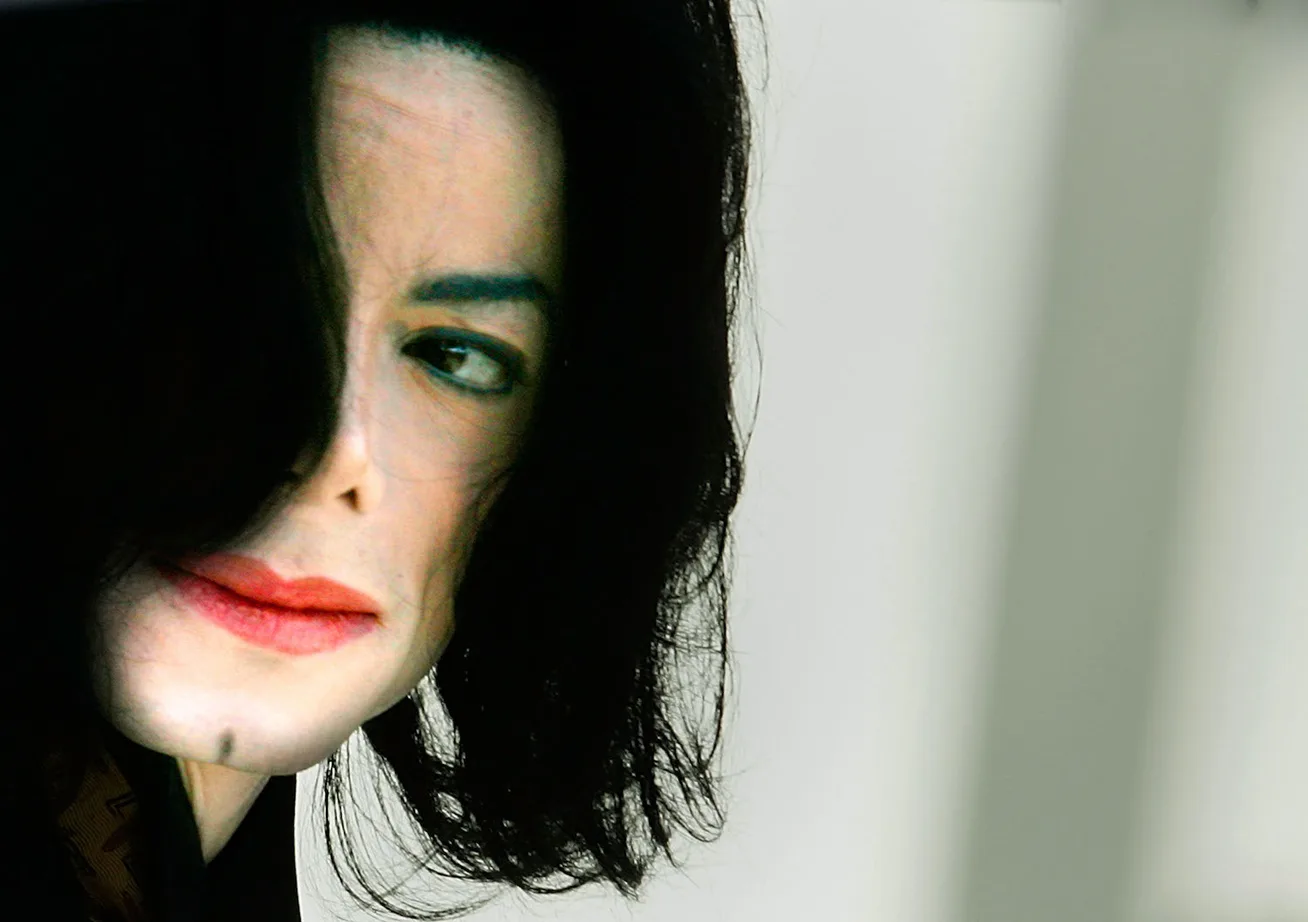 Michael Jackson Skin Disease (Vitiligo) Why did he turn white? New Idea