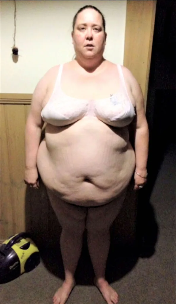 nurse weight loss