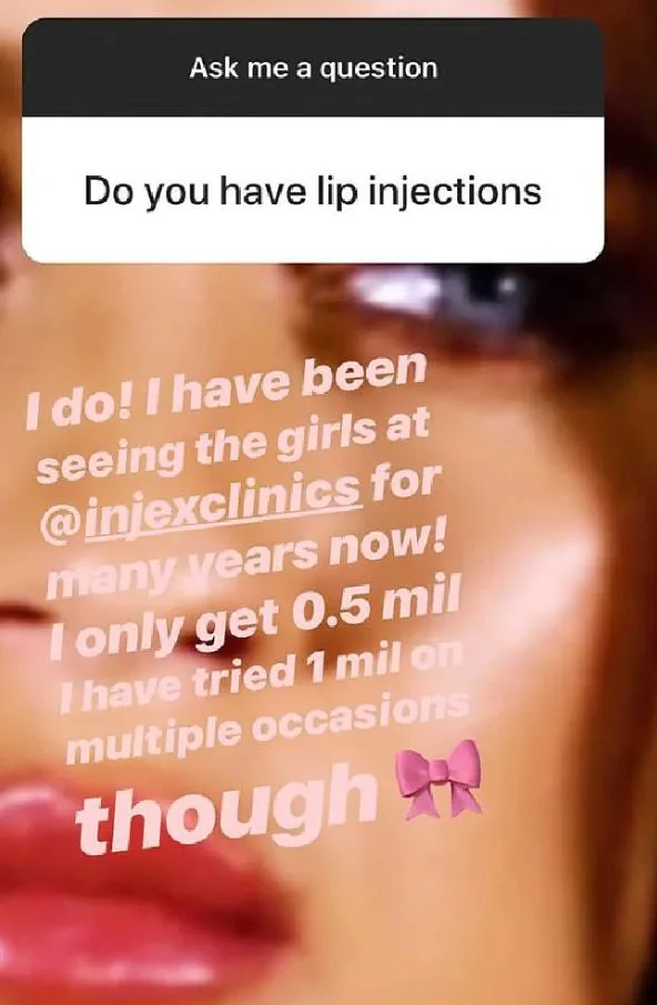 Ines Basic Instagram Q&A