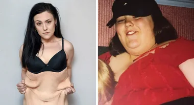 Woman asks strangers to PAY for her saggy skin removal