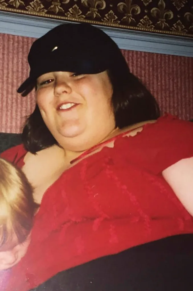 Excess skin removal weight loss crowdfunding