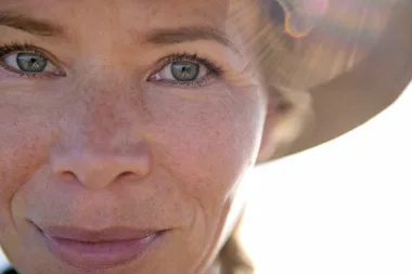 Everything you ever wanted to know about hyper-pigmentation