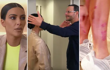 WATCH: Kim Kardashian turns to a Medium to help her Psoriasis