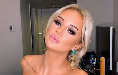 MAFS star Jessika shows off disturbing breast pictures