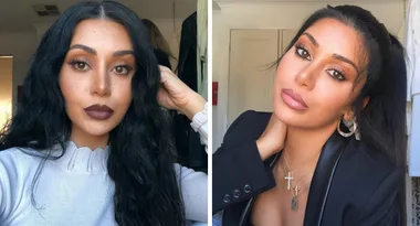 WATCH: MAFS Martha opts for a ‘make-under’ as she gets lip fillers dissolved on camera