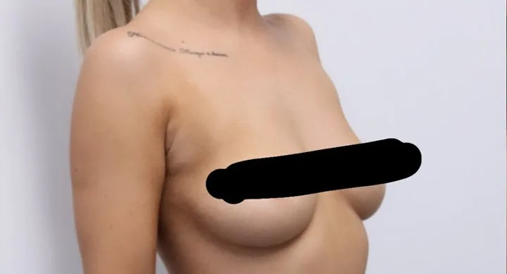 jess breasts