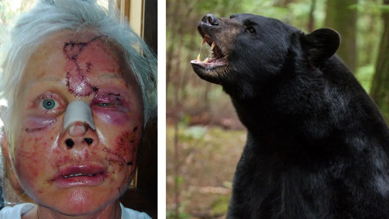 How I Survived: A bear ripped off my face!