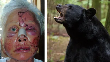 How I Survived: A bear ripped off my face!