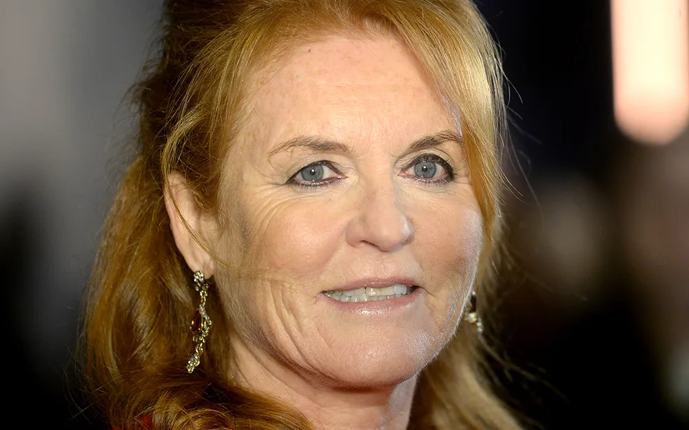 Sarah Ferguson plastic surgery