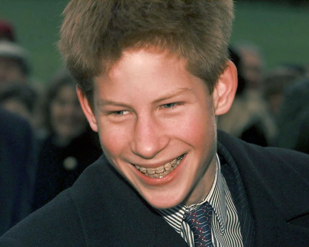 A young Prince Harry with braces