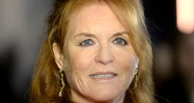 Fergie debuts new face after admitting to numerous cosmetic procedures