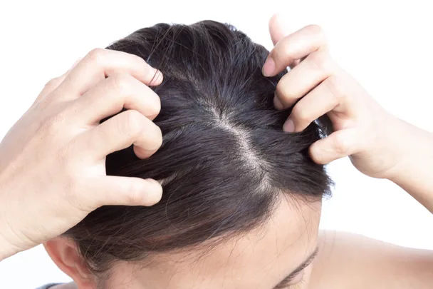 A woman scratching her head against a white background