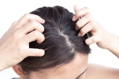 A woman scratching her head against a white background