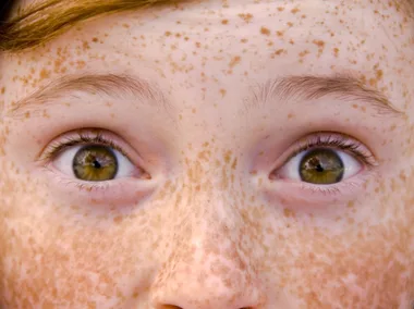 Skin Darkening In Some Spots? That Might Be Pigmentation