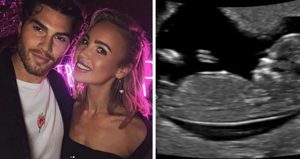 Love Island Justin Lacko expecting child girlfriend Anita Barone Scott
