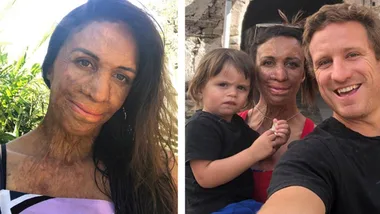 Turia Pitt reveals the things that make her confident