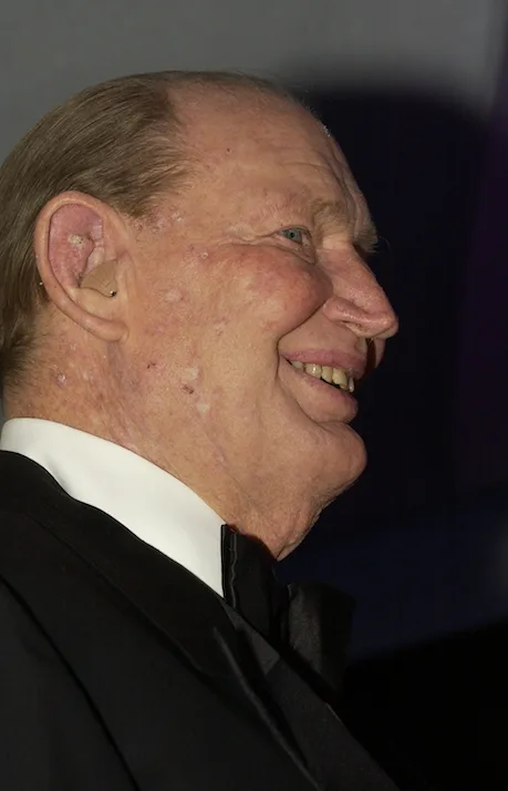 Kerry Packer